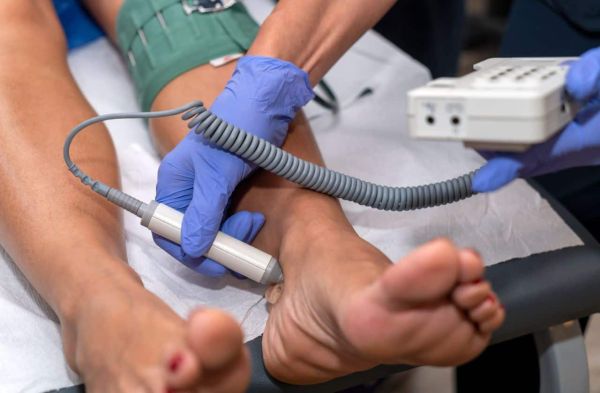 diabetic foot ulcer early stages
