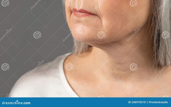 neck lines from sleeping