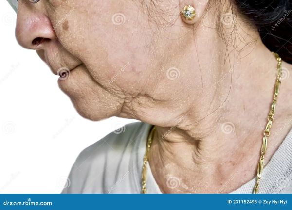 lines on women neck pics
