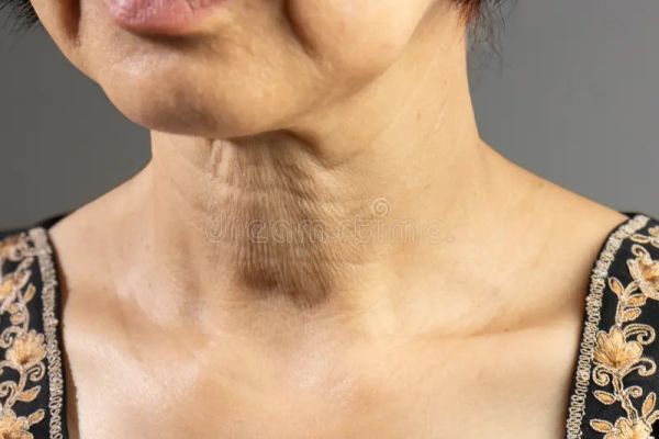 types of neck accessories
