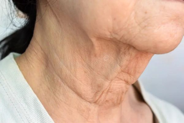 skinny person neck