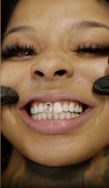 lost her teeth