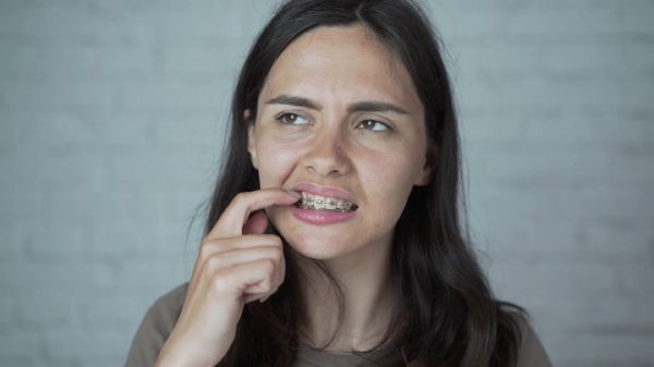 a woman pulled her teeth from visiting mexico
