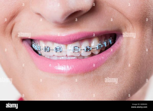 woman holding up shirt with her teeth
