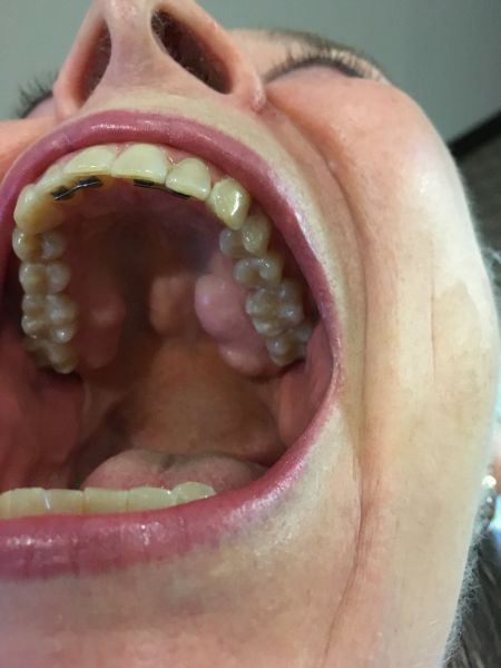 dental landmarks