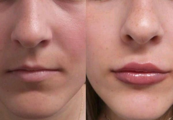 thin lips are beautiful