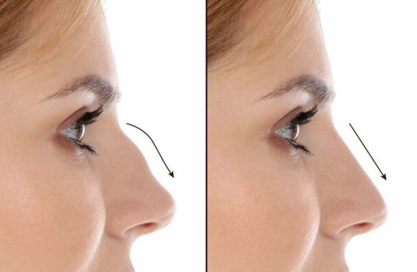 most beautiful nose