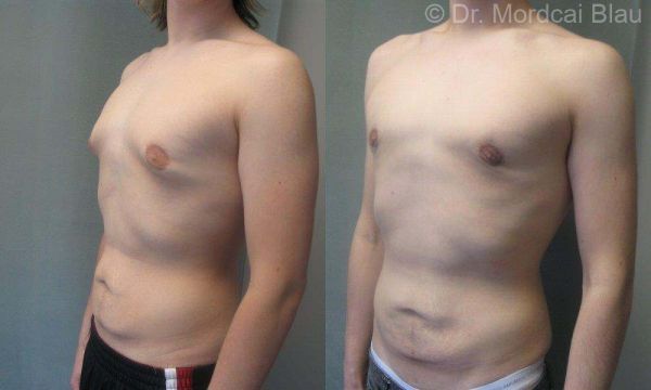 ultrasound appearance