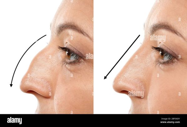 nose tip