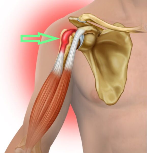 how to pop shoulder