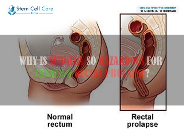what is mitral valve