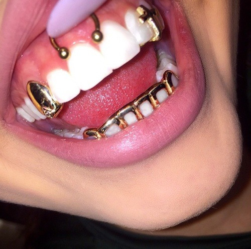 ugly teeth