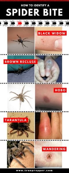 household spider bites