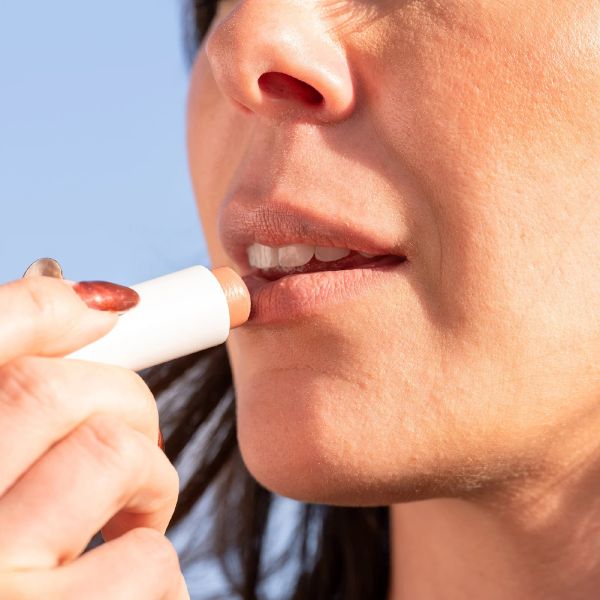 lower lip sun burn