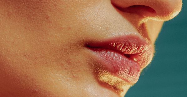 dry patches on lips