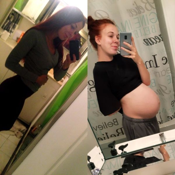 dramatic weight loss before and after
