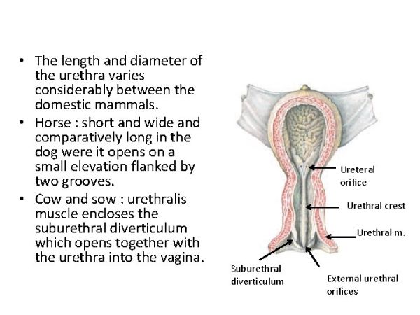 diverticulum of urethra