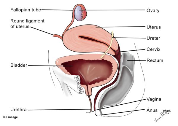 retropubic mid urethral sling