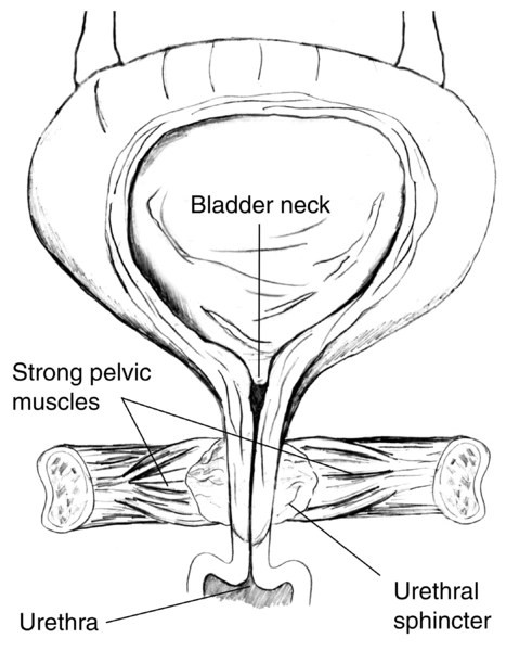 urethral cork rings