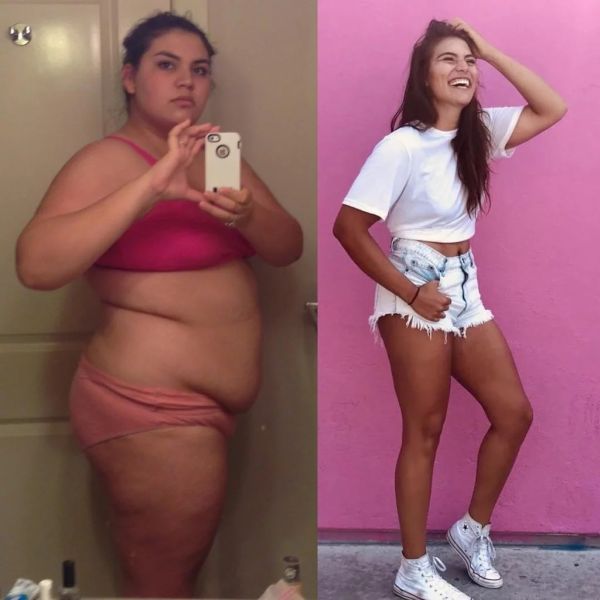 face fat before and after weight loss