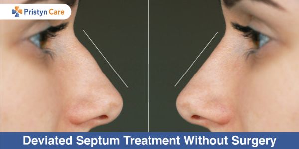 how to know if i have a deviated septum